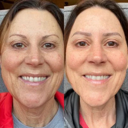 Plumping Serum mot Pigmentering og Mørke Flekker