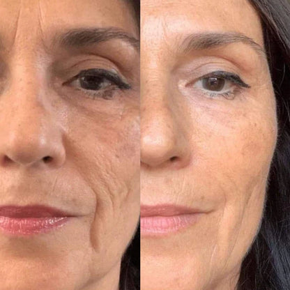 Plumping Serum mot Pigmentering og Mørke Flekker
