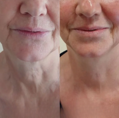 Anti-Aging Kit for Glattere Hud og Fastere Hals